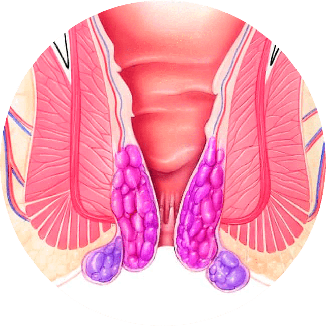 Gelarex verlicht de symptomen vanaf het eerste gebruik